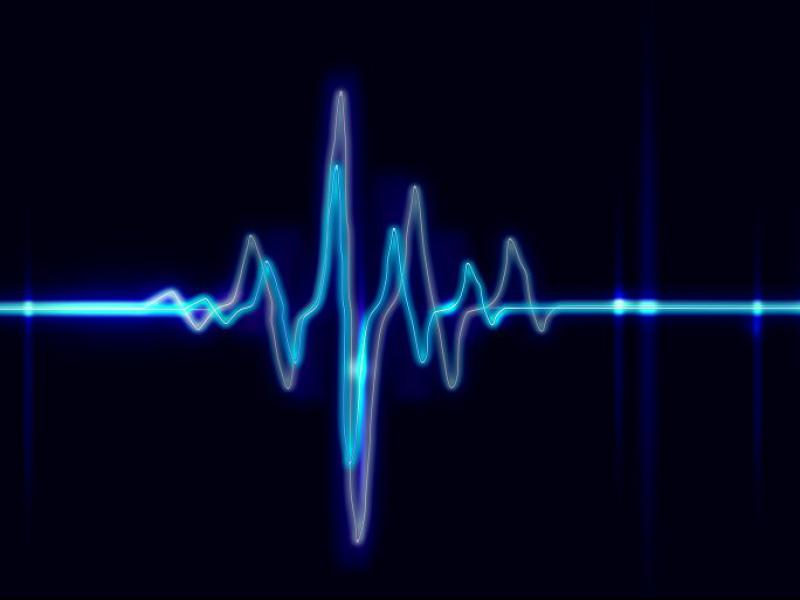 دانلود-تصویر-با-کیفیت-خط-اکولایزر