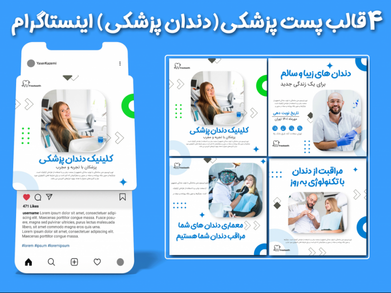 قالب-پست-اینستاگرام-پزشکی-(دندان-پزشکی)