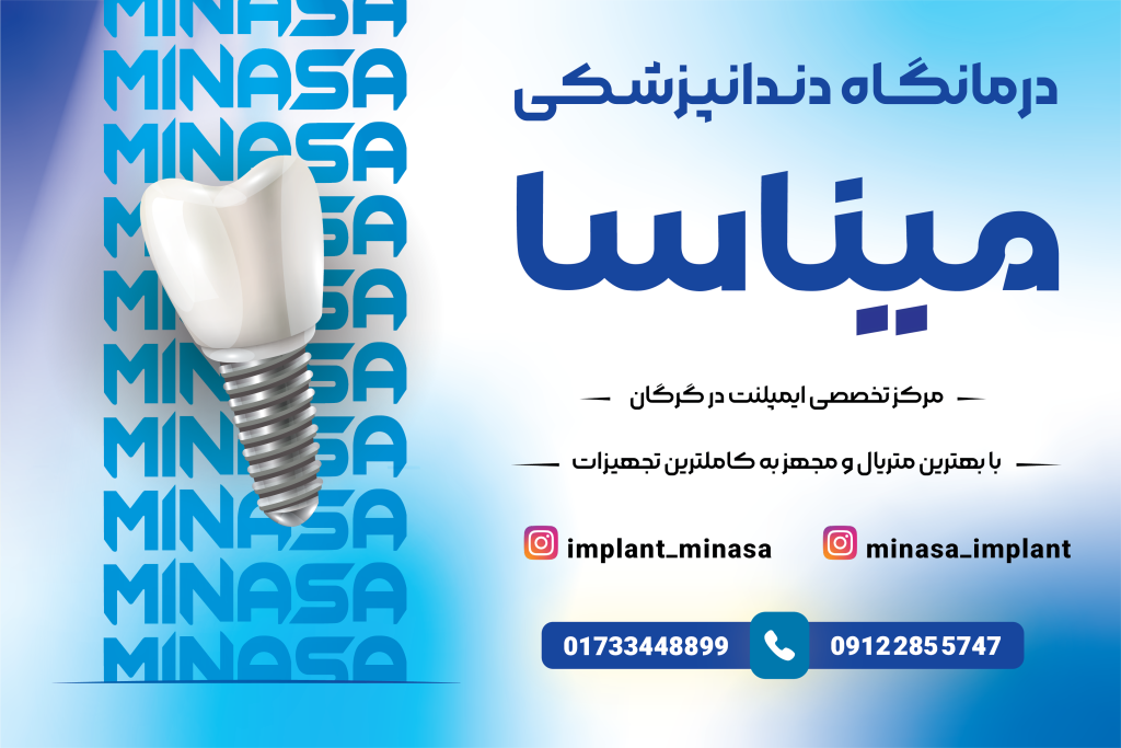 کارت ویزیت ایمپلنت دو طرفه